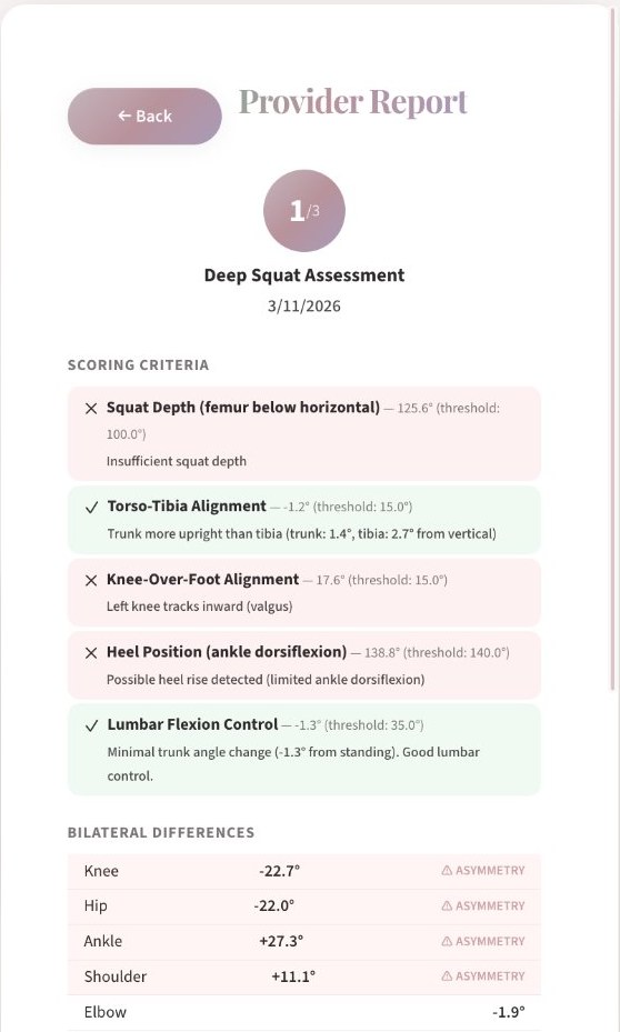 A generated report: score of 1 out of 3, five criteria each with a measured angle and its threshold, and left-right differences